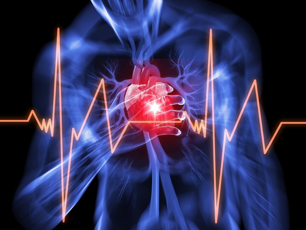 Heart Attack